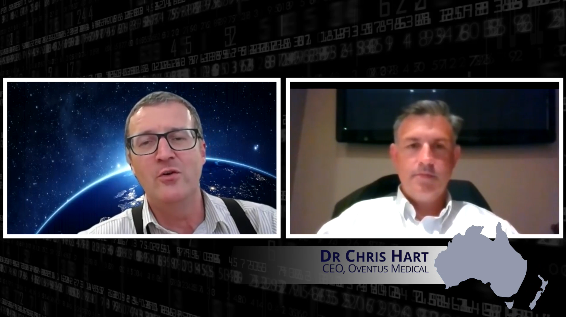 Oventus Medical (ASXOVN) Interview with CEO Chris Hart Stocks Down