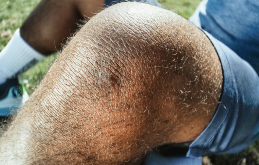 Paradigm Biopharmaceuticals