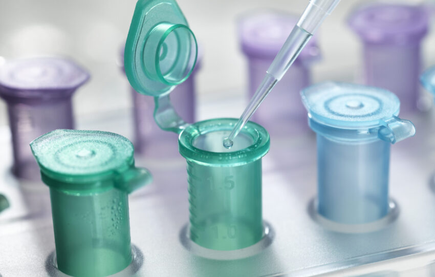 Alterity Therapeutics