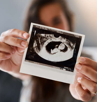 monash ivf shares