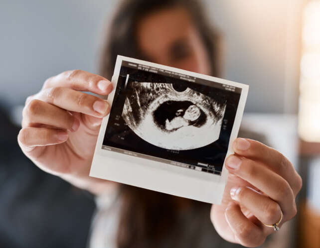 monash ivf shares