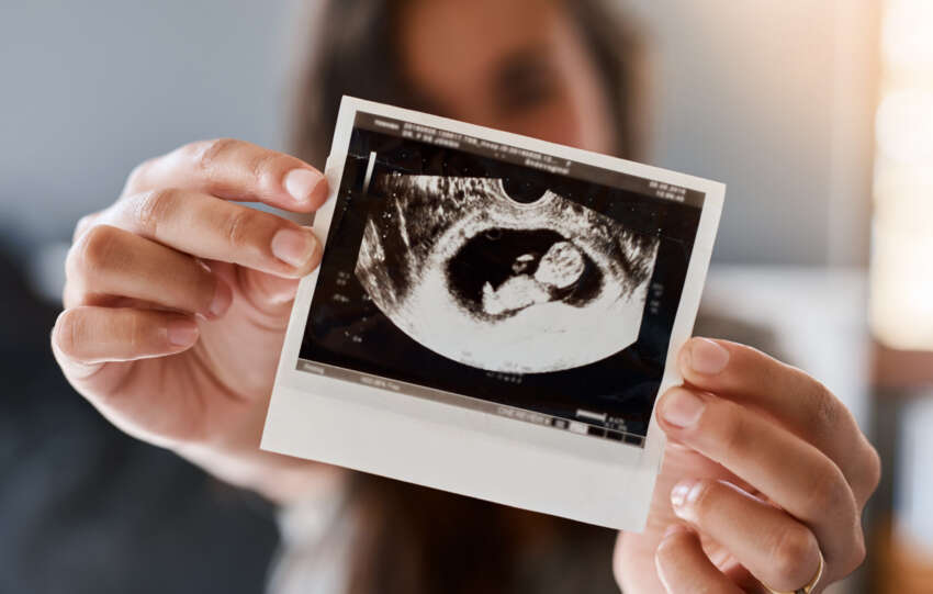 monash ivf shares