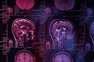 Telix Pharmaceuticals