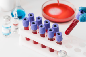 Proteomics International