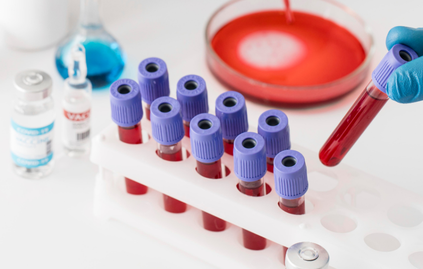 Proteomics International