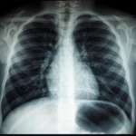 4DMedical