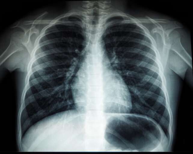 4DMedical