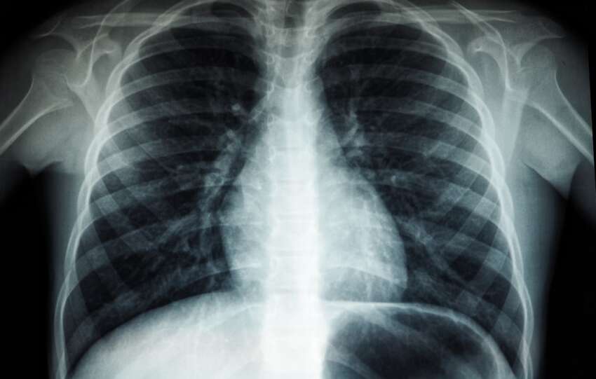 4DMedical