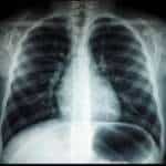 4DMedical
