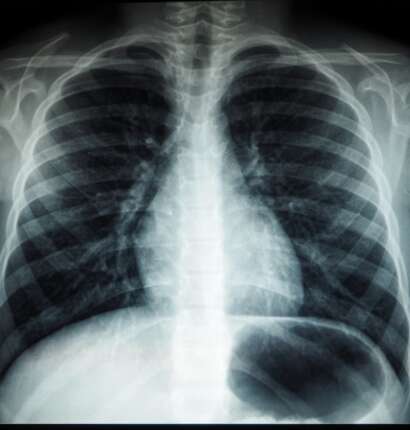 4DMedical